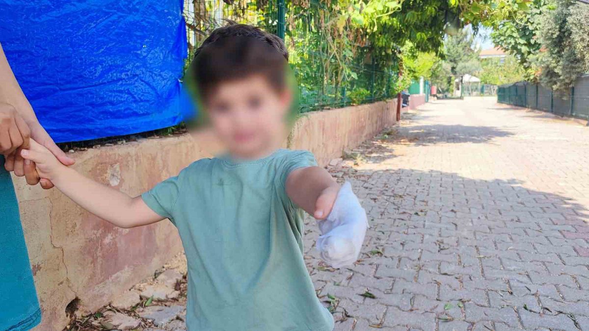 Polis Eskortuyla Hastaneye: 3 Yaşındaki Çocuğun Eli Kurtarıldı