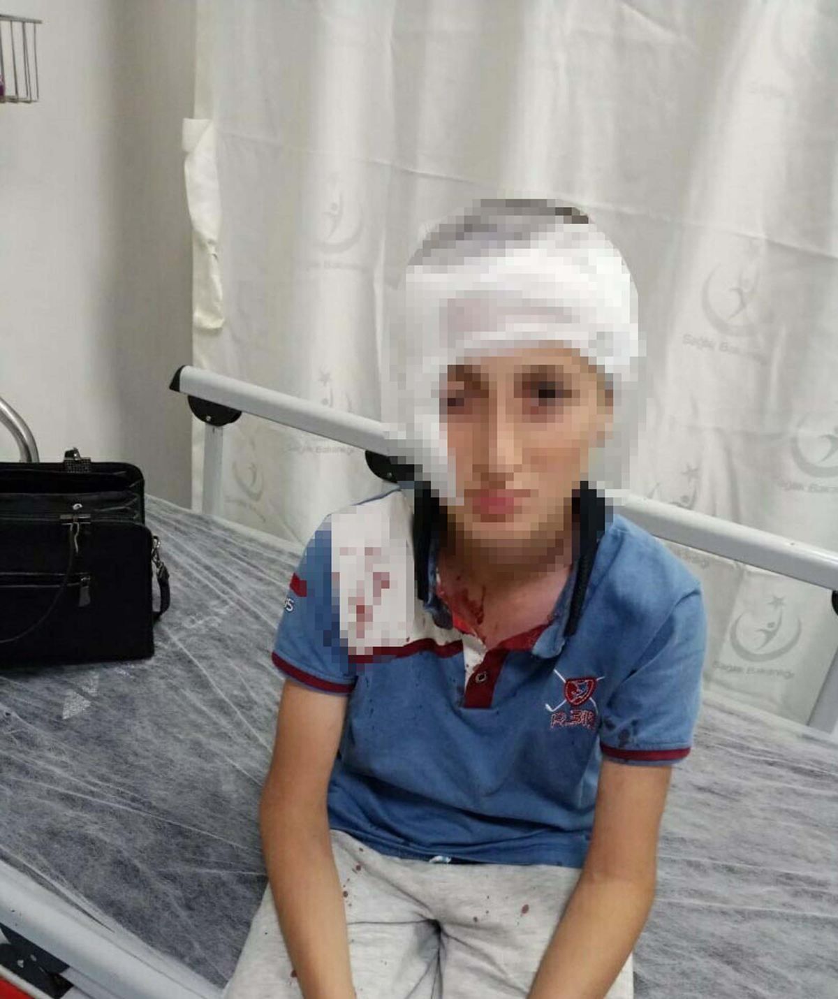 Köpek saldırısında yüzü kalıcı iz kalan çocuk için 1,2 milyon TL tazminat