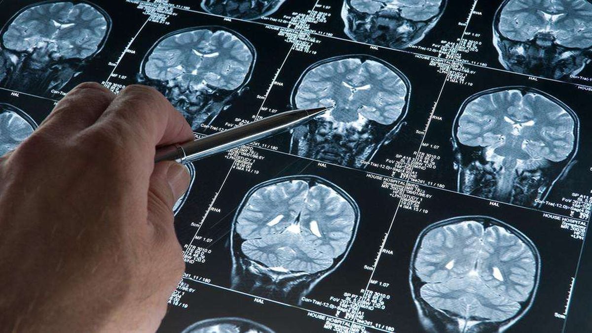 Araştırma: Derin uyku Alzheimer’ı yavaşlatıyor