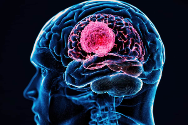 Laboratory research on brain tumor treatment