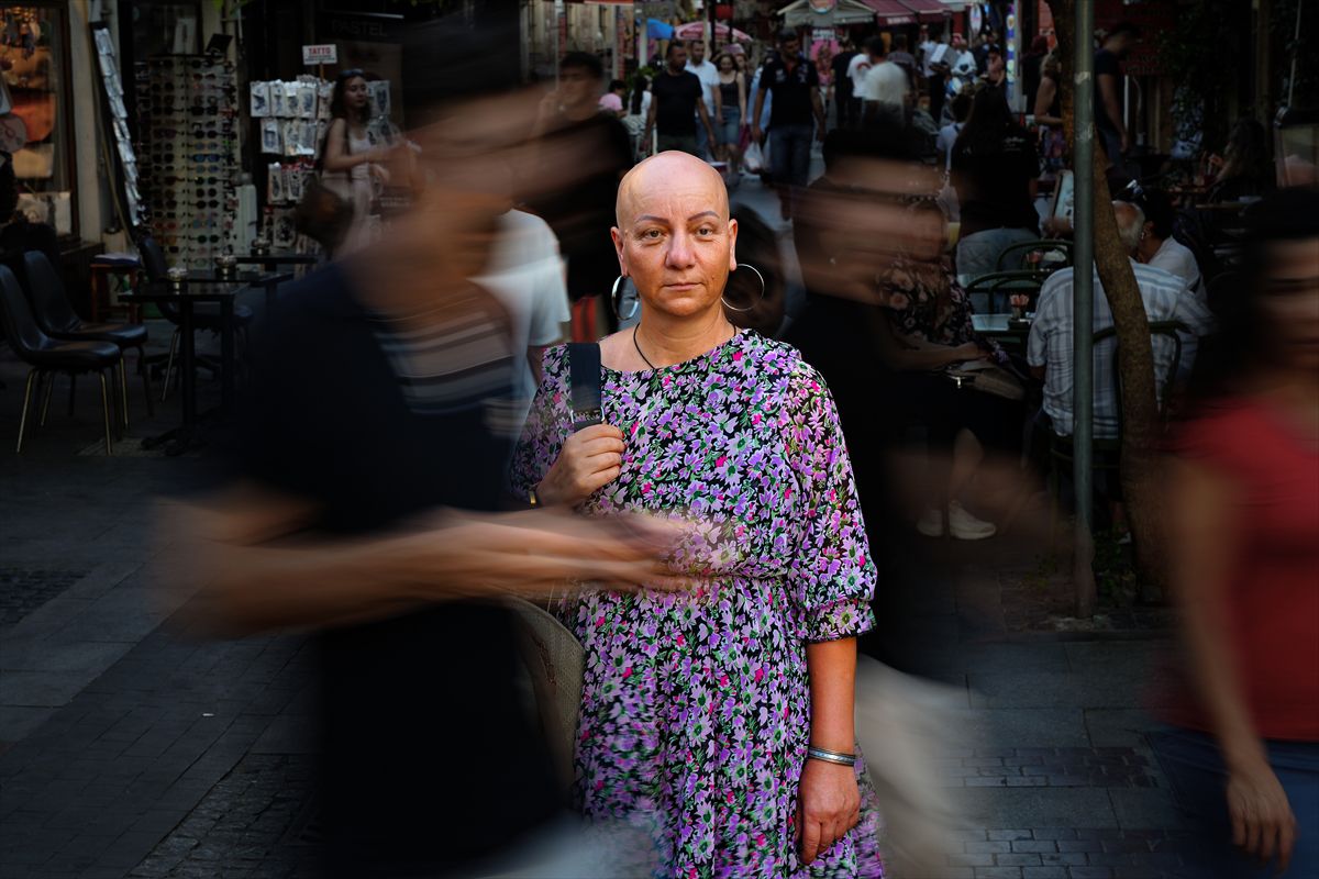 Alopesiyle Barışan Arzu Özsoy, Önyargılara Karşı Mücadele Ediyor