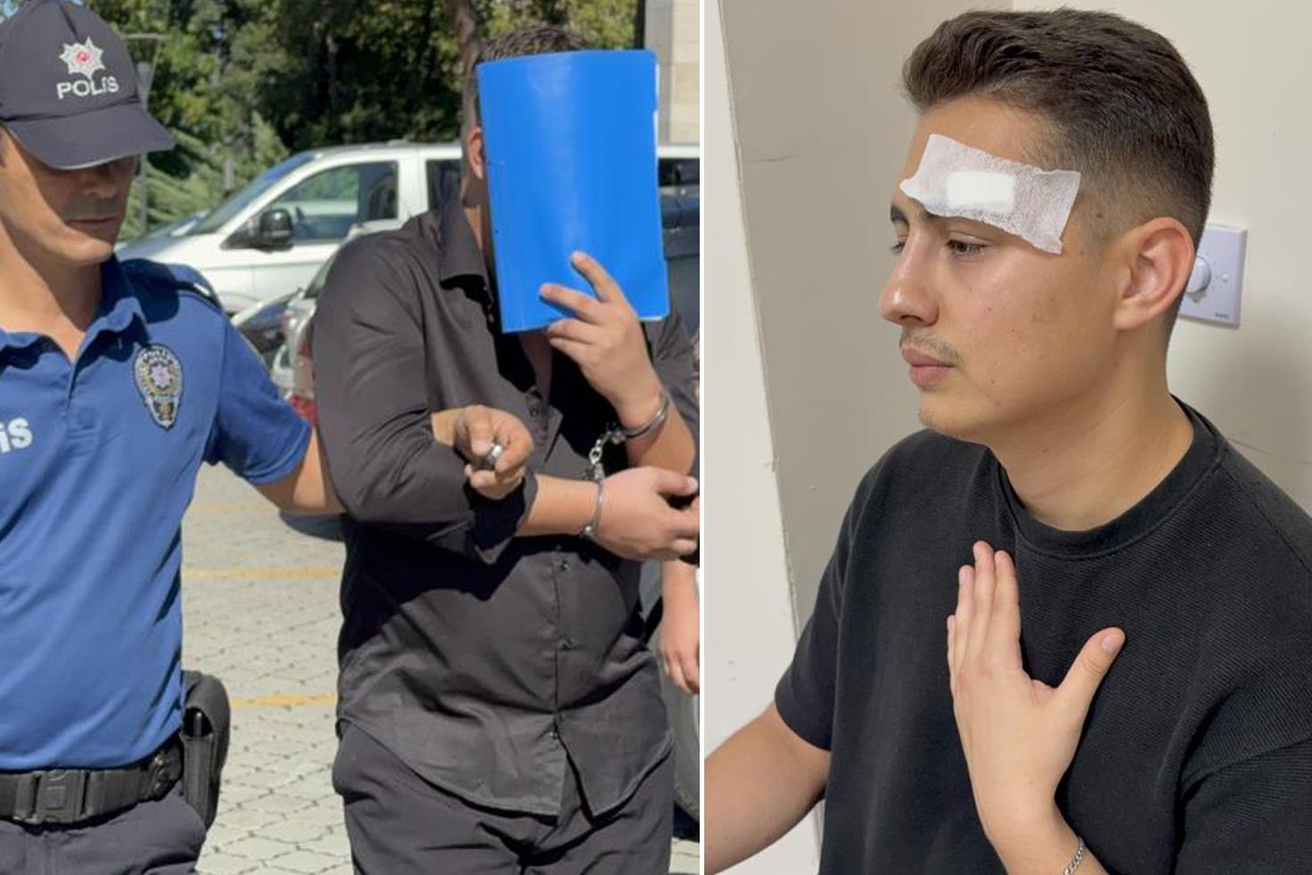 Hastanede dehşet: Hasta yakınının su ısıtıcısıyla saldırdığı röntgen teknisyeninin omzu kırıldı