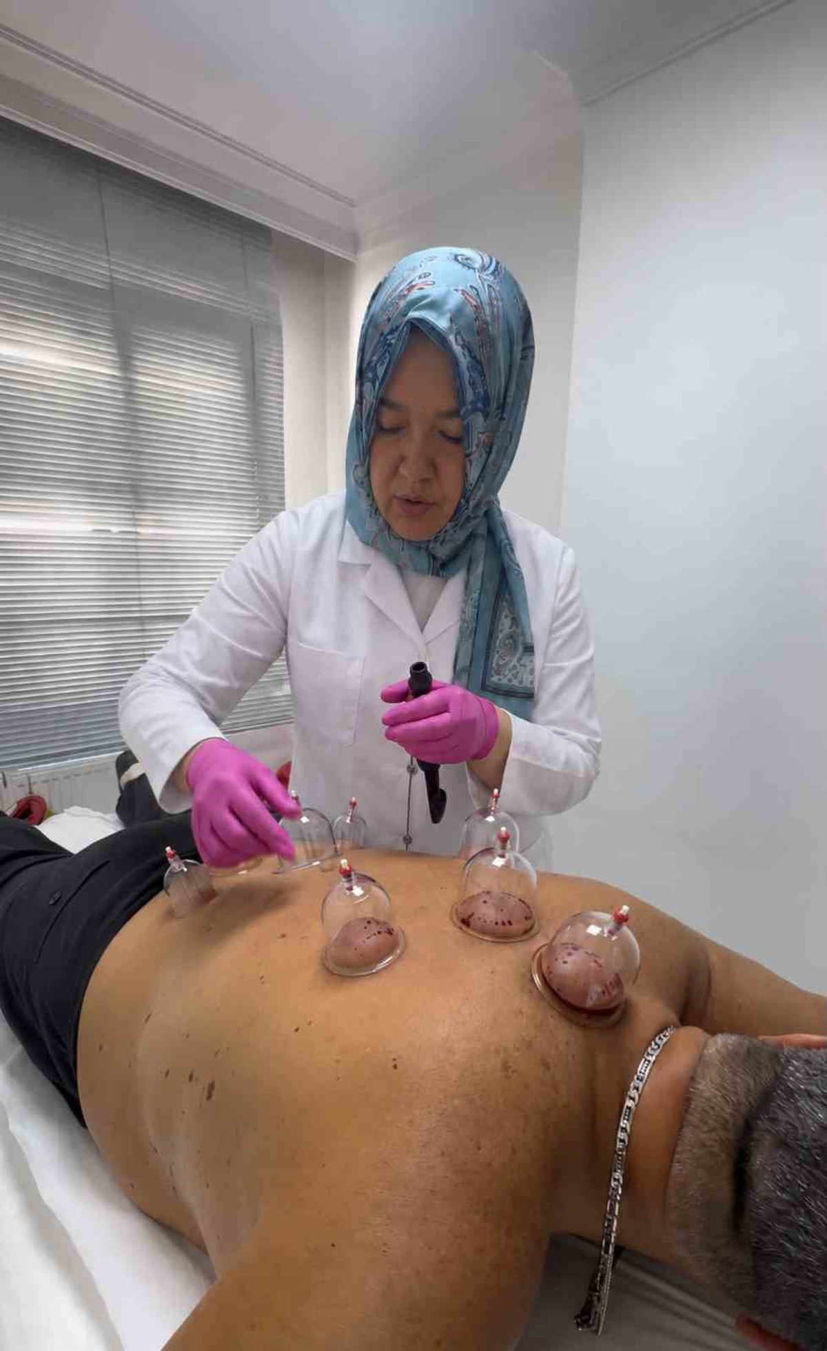 Dr. Esra Çetin Timur’dan hacamat uyarısı: 'Bu uygulamayı hekim bizzat yapmalı'
