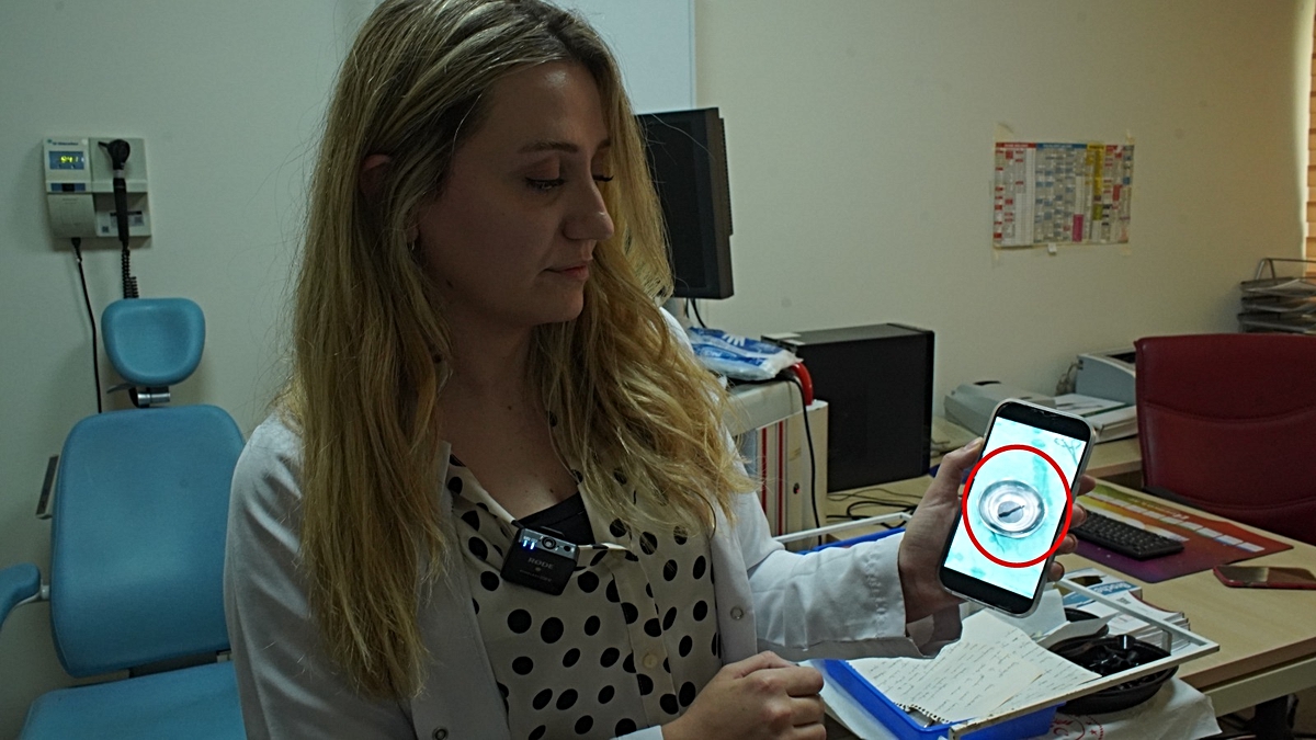 Siirt'te 10 yaşındaki çocuğun boğazından canlı sülük çıkarıldı