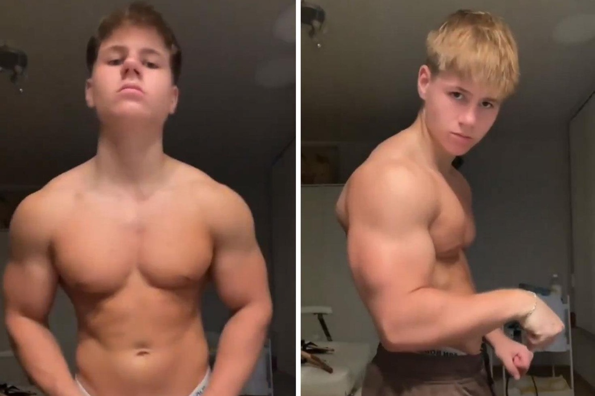 17 yaşında steroid kullanmaya başladı! 20 yaşındaki halini görenler inanamadı