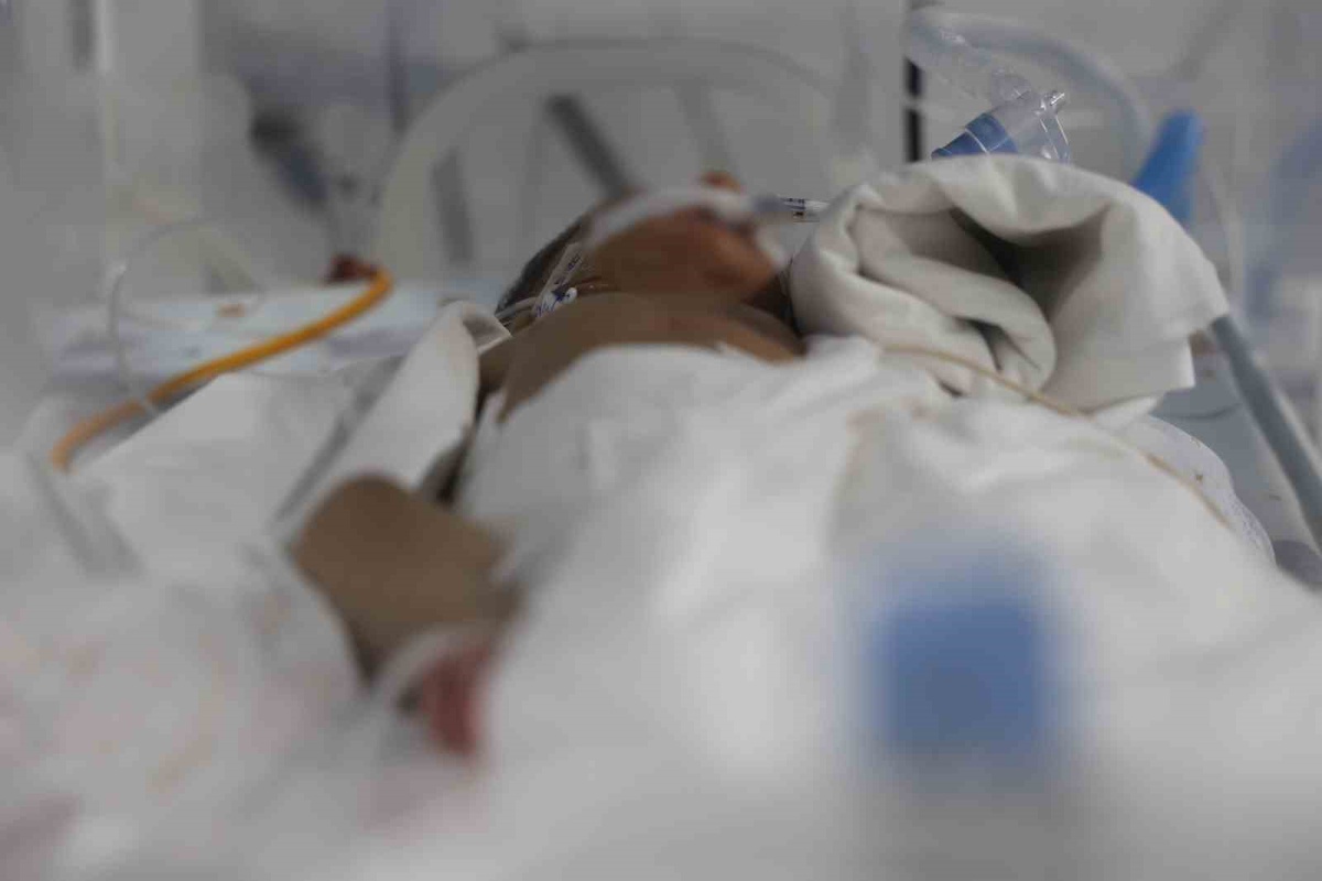 Hatay'da 31 haftalık prematüre bebek bağırsak tıkanıklığından ameliyatla kurtuldu