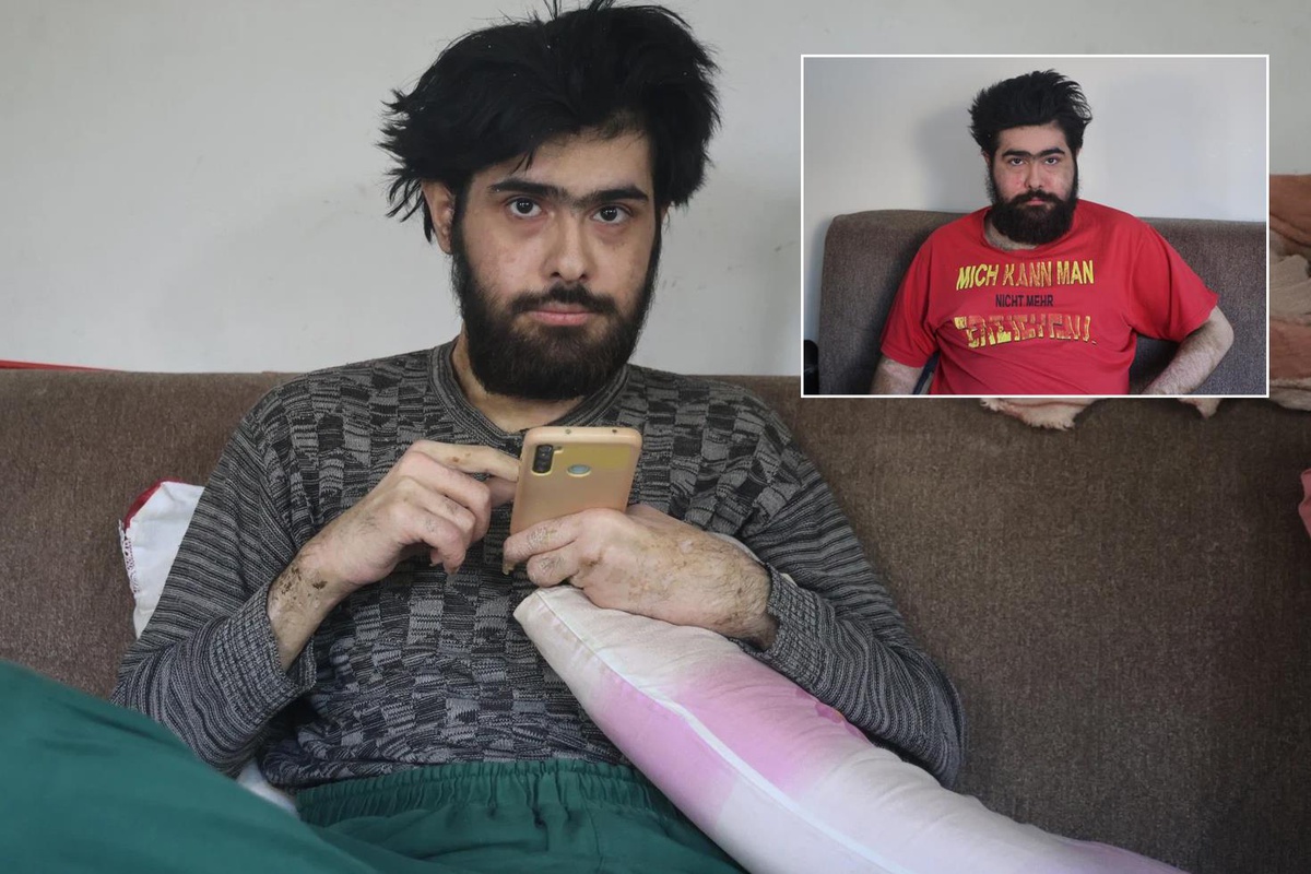 3 ay tedavi gördü ama olmadı! Barış Özbay eski hayatına geri döndü