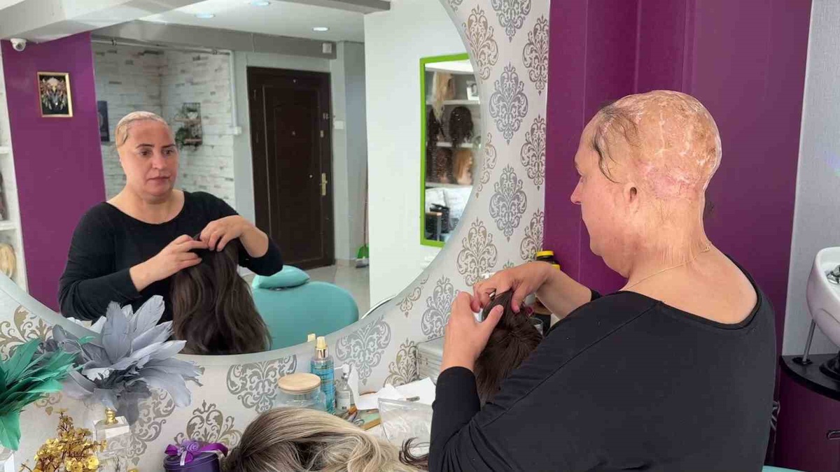 Saçlarını ve kulaklarını kaybeden Asiye Koçuk, 34 yıldır ücretsiz peruk yapıyor