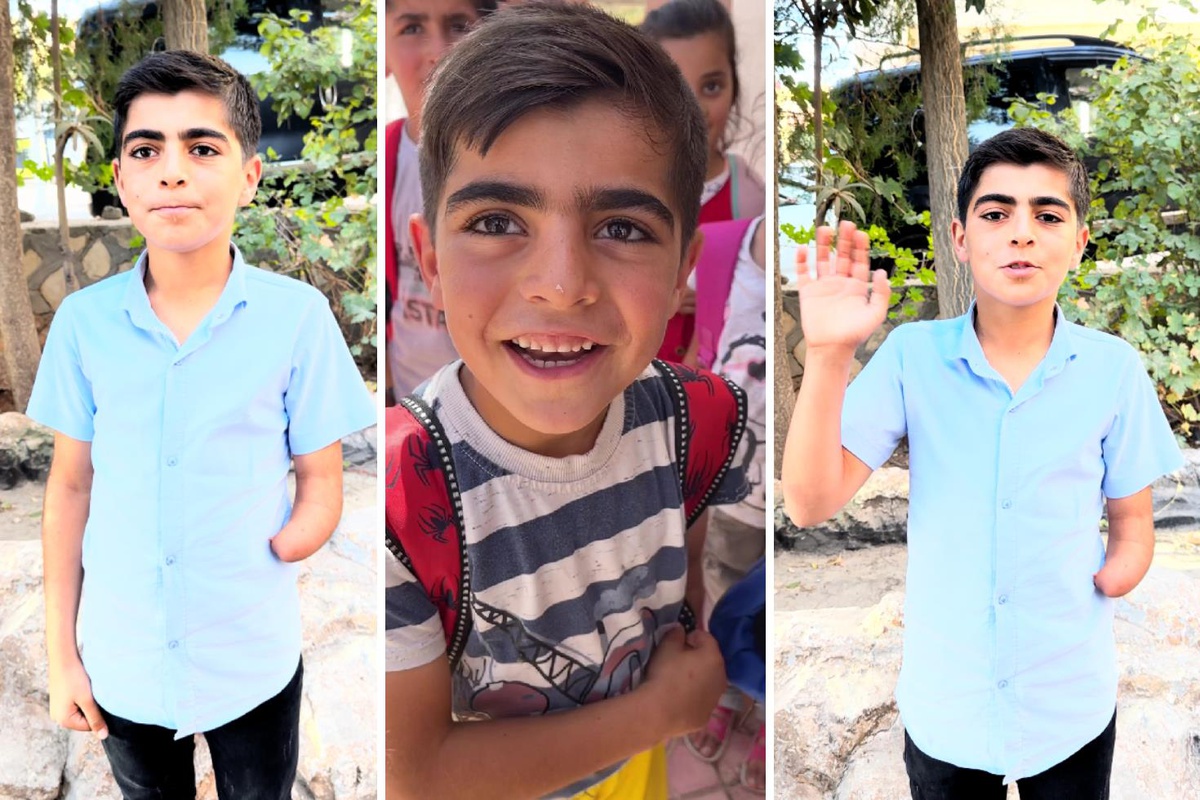 Milyonların gülümsediği Miran’ın doğum günü hayali: Yeni bir protez kol