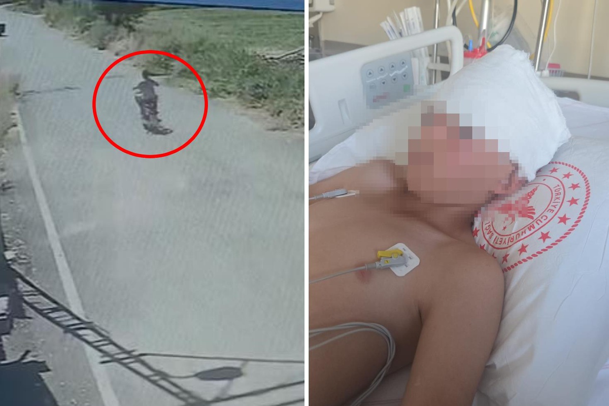 11 yaşındaki çocuğa çarpıp kaçtı, 'O bana çarptı' dedi! Aile adalet bekliyor
