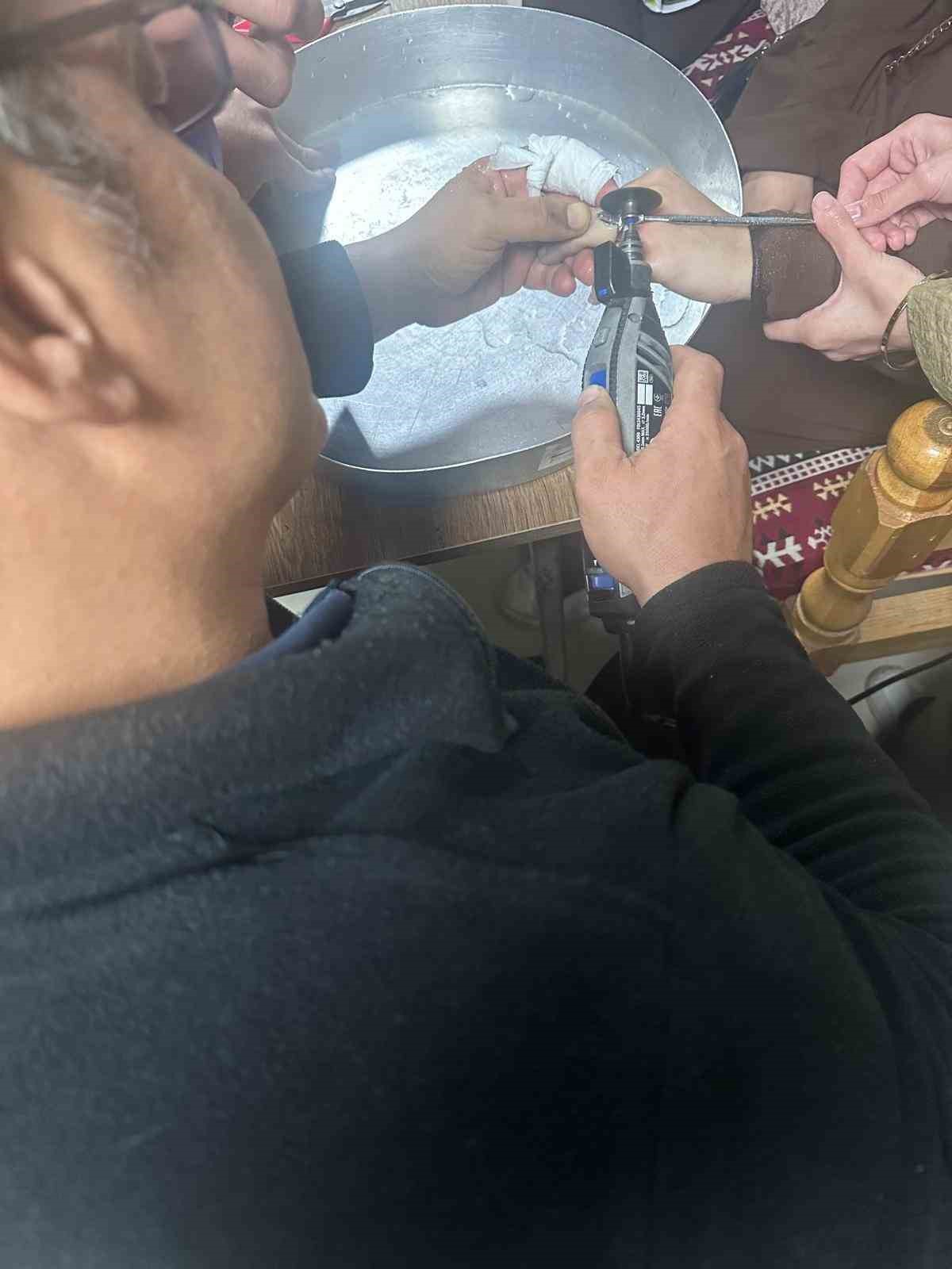 Parmağına yüzük sıkışan vatandaşın imdadına Batman'daki hastanede itfaiye yetişti