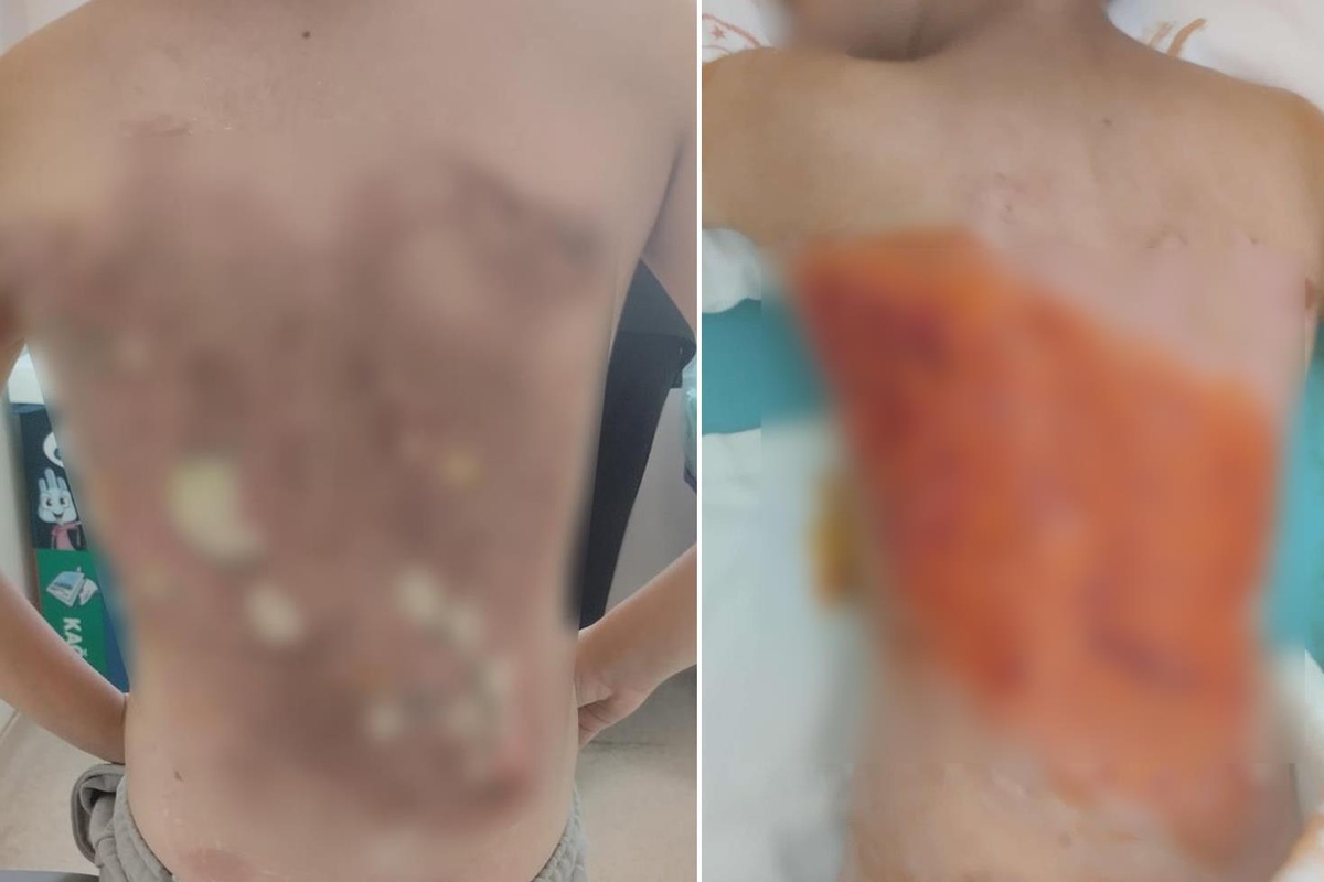 12 yaşındaki çocuğu diri diri yaktılar! Sonrası daha da korkunç