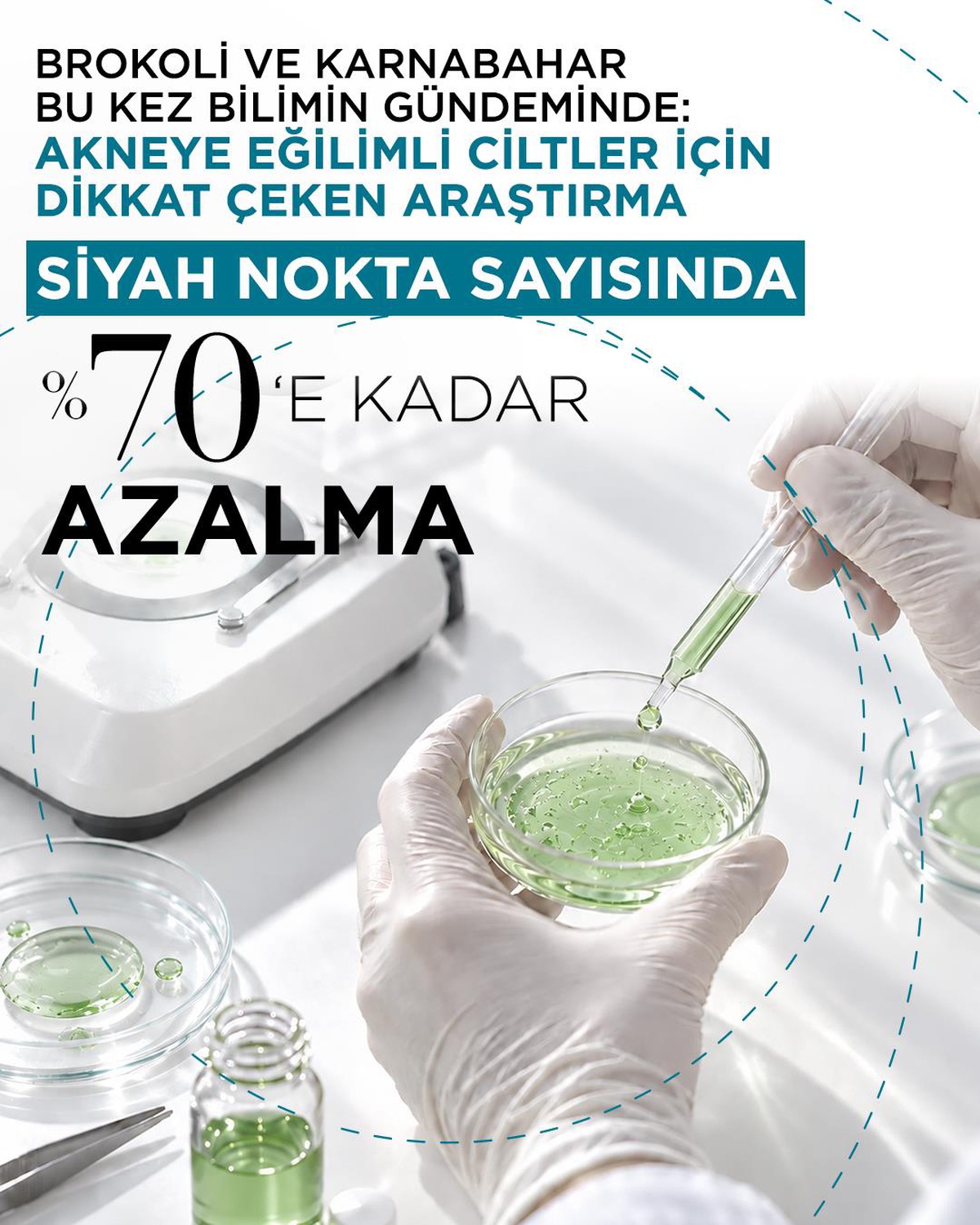 BROKOLİ VE KARNABAHAR BU KEZ BİLİMİN GÜNDEMİNDE: AKNEYE EĞİLİMLİ CİLTLER İÇİN DİKKAT ÇEKEN ARAŞTIRMA