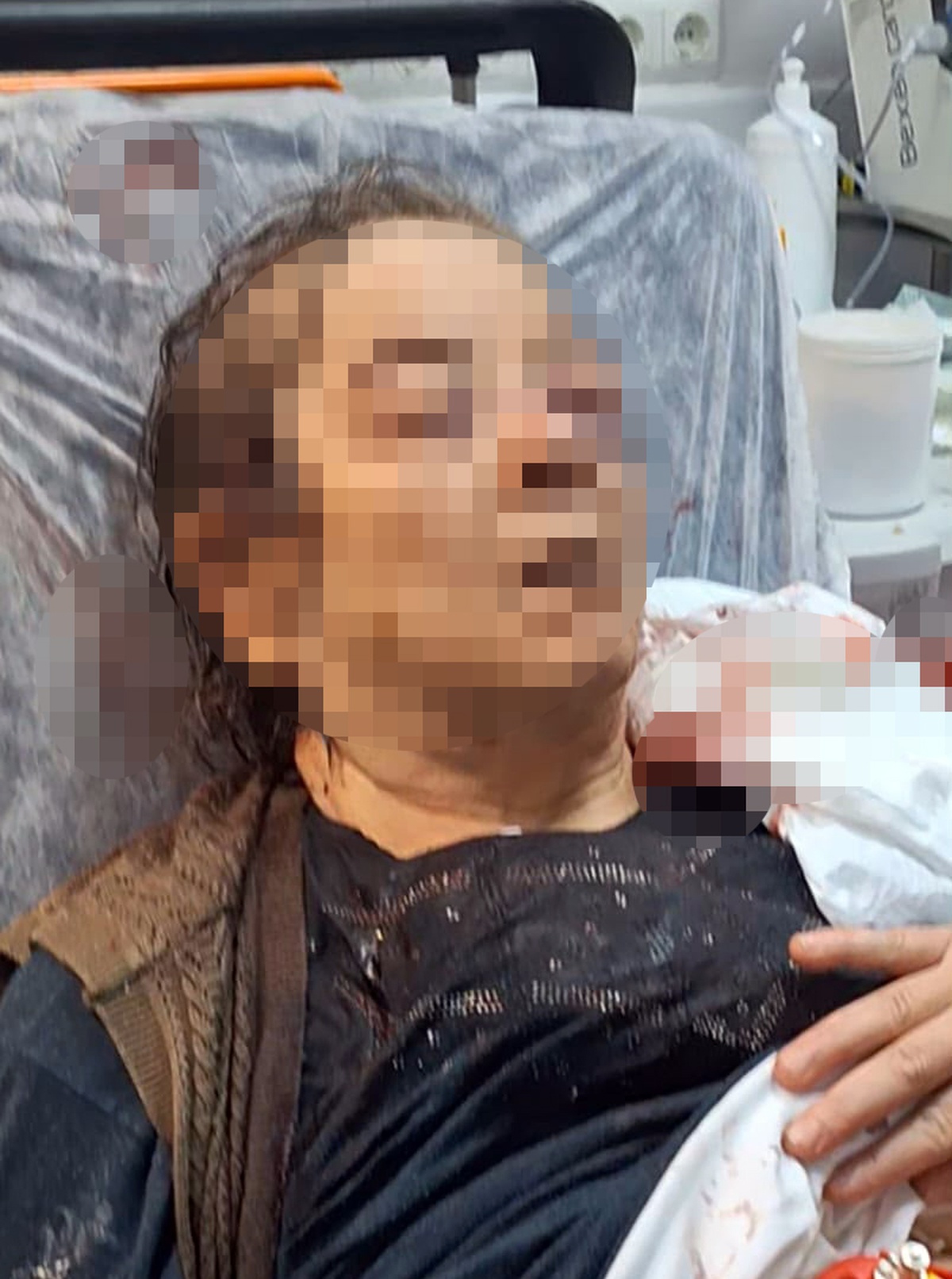 Kayseri'de evinde otururken tavan sıvası üzerine çöktü! 75 yaşındaki kadının sol gözünde ciddi görme kaybı