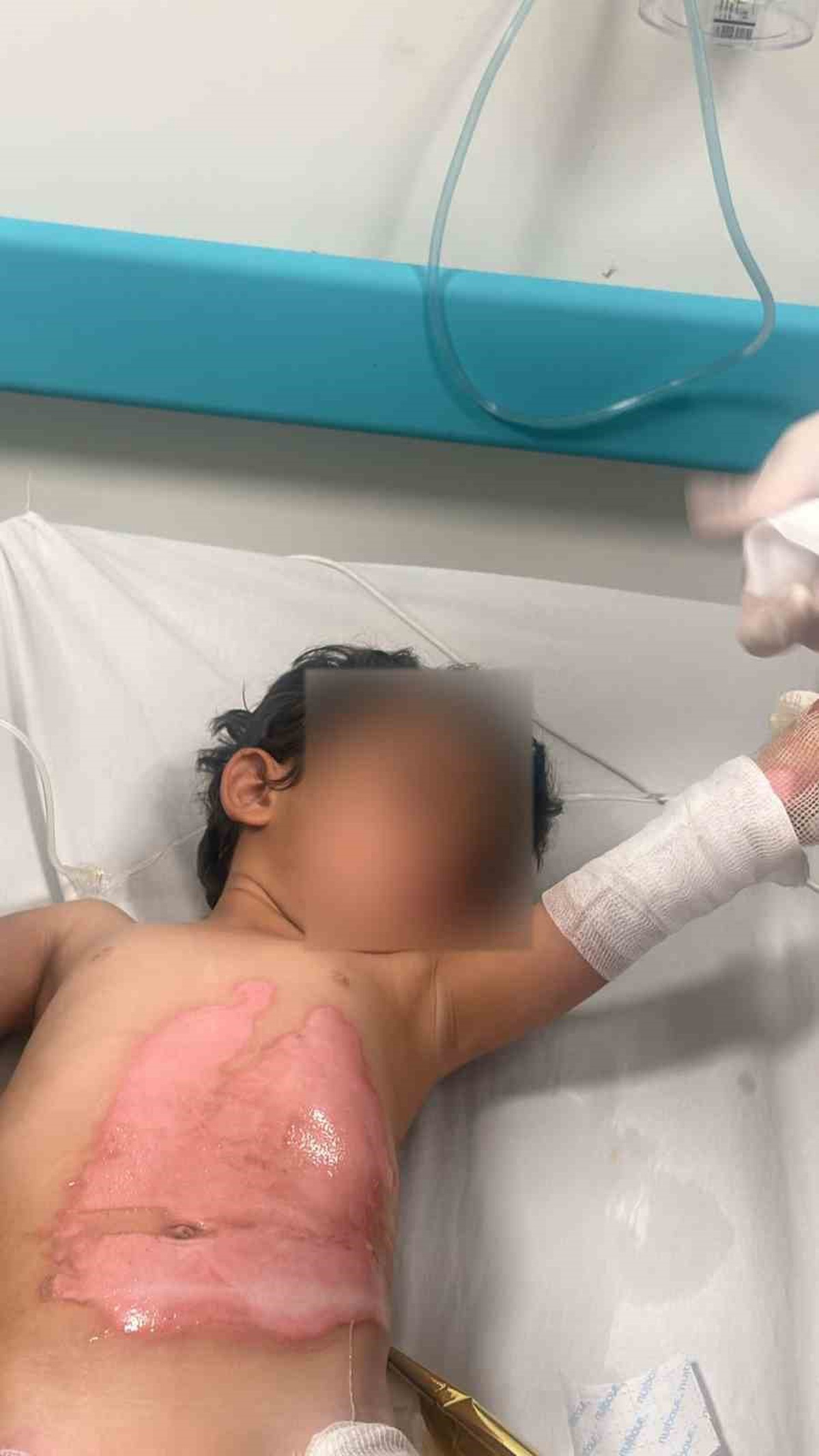 İddiaya göre Şırnak Kumçatı'da banyoda ısıtılan kaynar su 3 yaşındaki çocuğu yaraladı