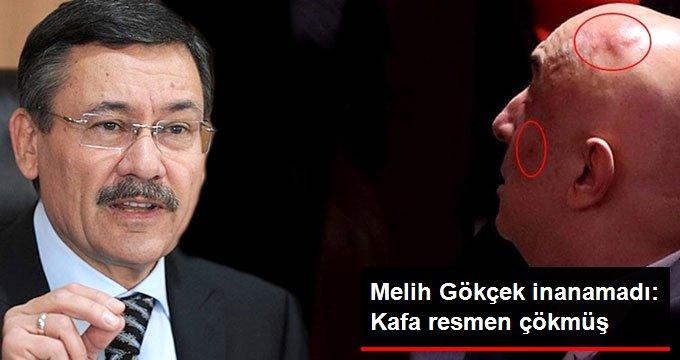 Melih Gökçekten CHPli Özkoçun kavga sonrası ortaya çıkan fotoğrafına ilk yorum: Kafa resmen çökmüş