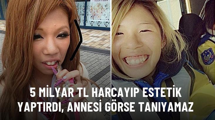 5 milyar TL harcayıp estetik yaptırdı, annesi görse tanıyamaz