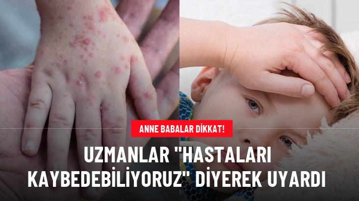 Kızamık ve boğmacaya karşı uzmanlar uyarıyor: Vakalar artıyor, tedbirleri almak gerekiyor