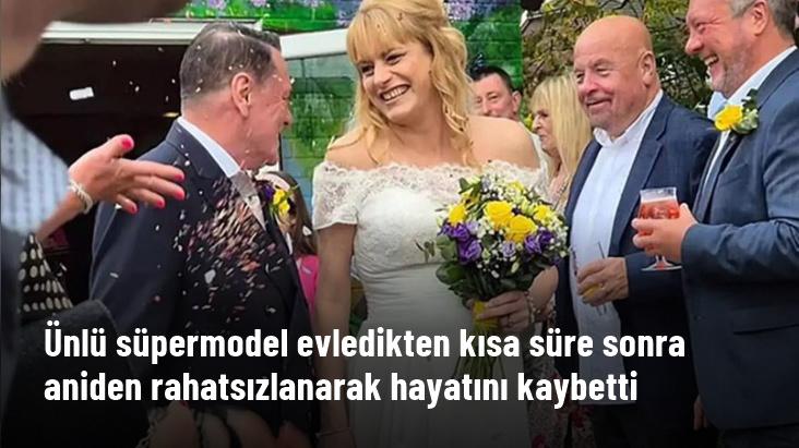 Ünlü süpermodel evledikten kısa süre sonra aniden rahatsızlanarak hayatını kaybetti