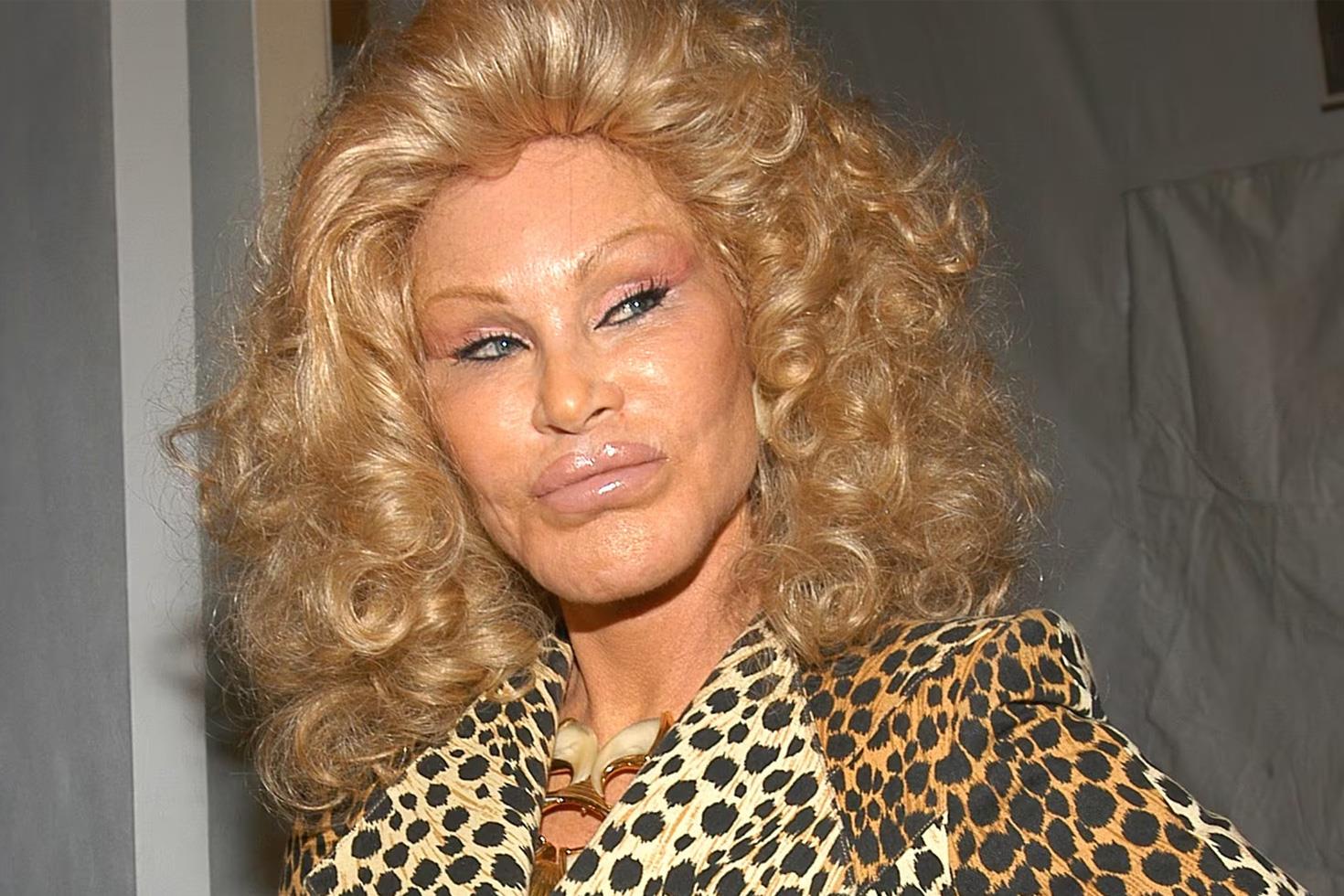 'Kedi Kadın' lakaplı Jocelyn Wildenstein hayatını kaybetti