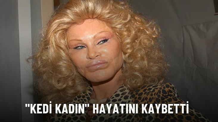 'Kedi Kadın' lakaplı Jocelyn Wildenstein hayatını kaybetti