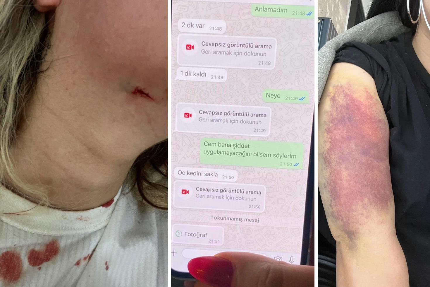 Eski sevgilisi kapıyı kırıp boğazını sıkarak darbetti, dehşeti saniye saniye kaydetti