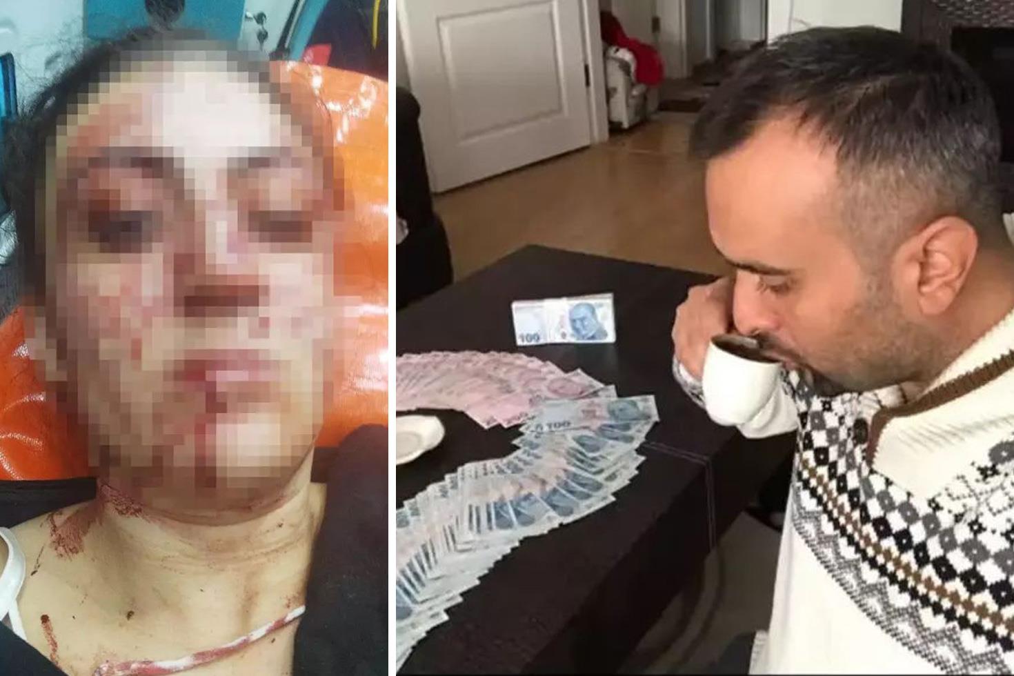 Eski eşini 7 yerinden bıçakladı, mahkeme hakaret etti diyerek cezasını indirdi