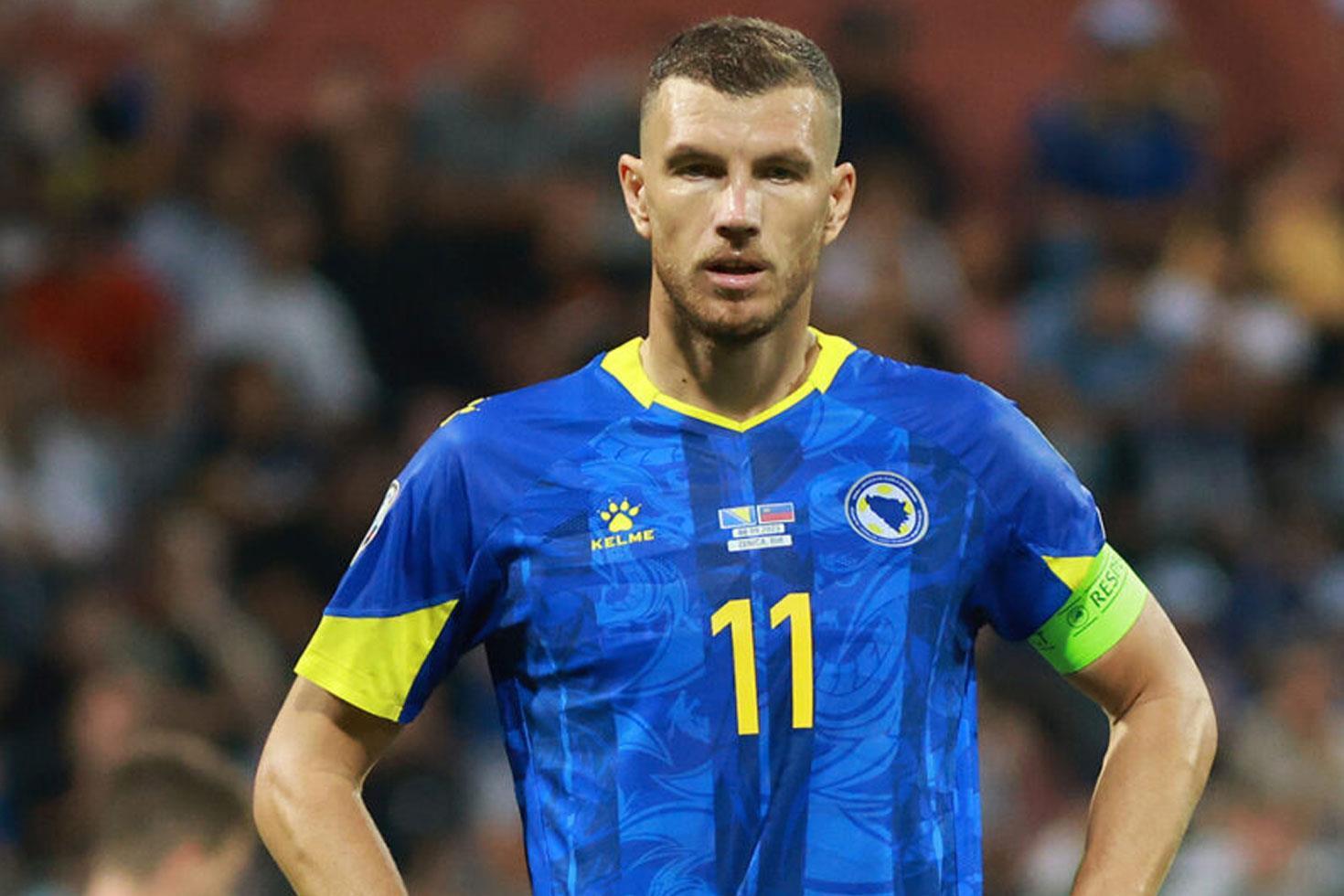 Burnu kırılan Dzeko'dan kahreden haber