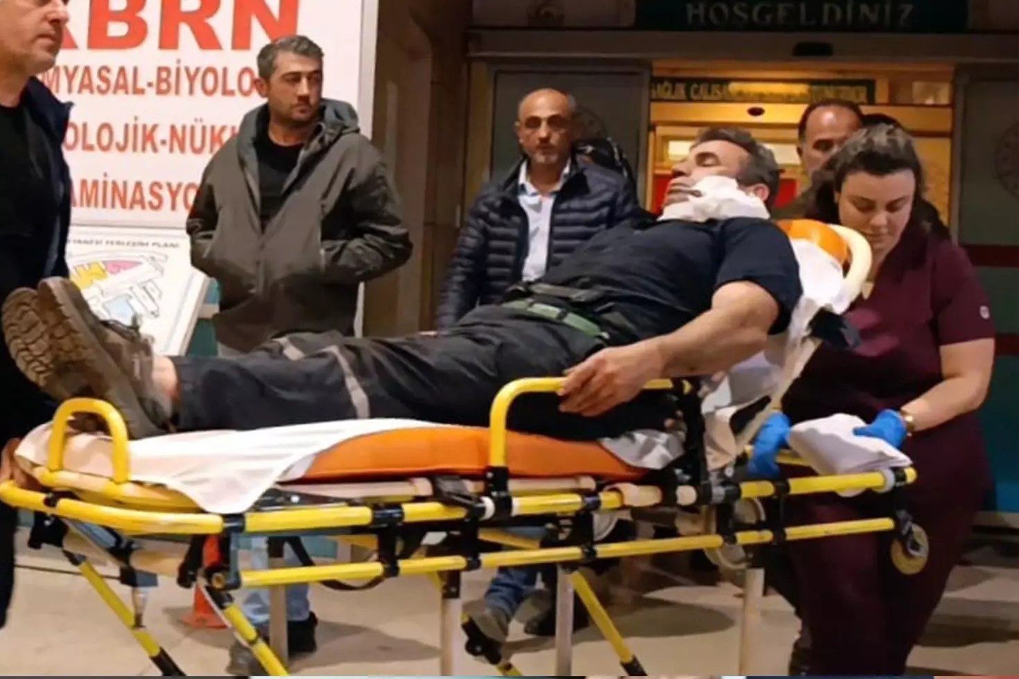 Kömürleri indirirken yüzüne demir saplandı