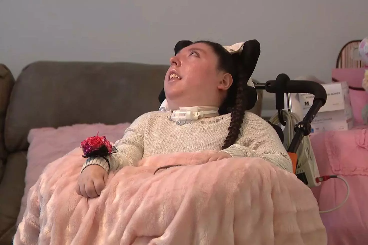 Beyinsiz doğan Alex 20 yaşında, doktorlar 5 yıl yaşamaz demişti