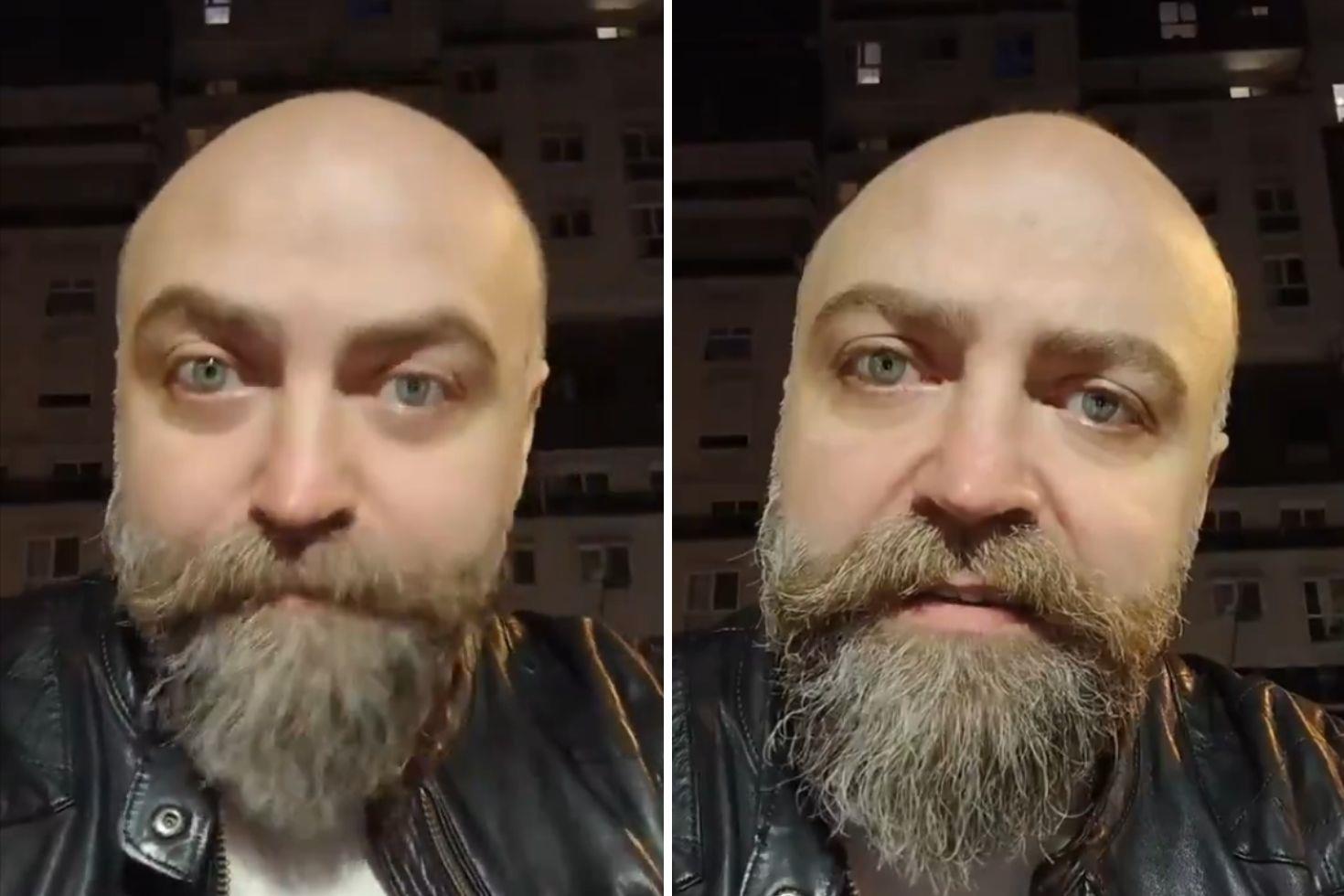 Saçsız adam isyan etti Berbere ödediği ücret öyle böyle değil