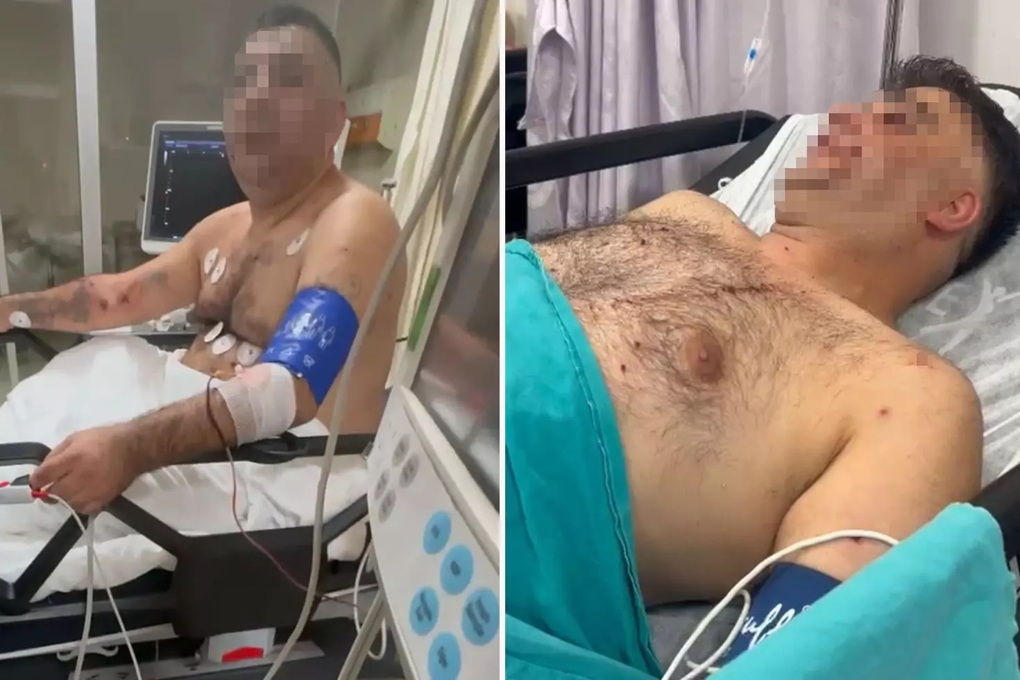 Bayrampaşa’da pompalı tüfekle çevreye ateş eden şahıs, 1’i polis 4 kişiyi yaraladı