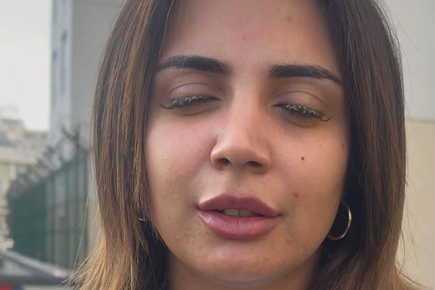 Güzelleşeyim derken az daha kör oluyordu