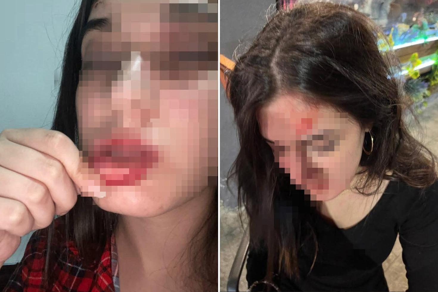 Eski sevgili dehşeti “Beni tuzağa düşürdü“ deyip fotoğraflarını paylaştı