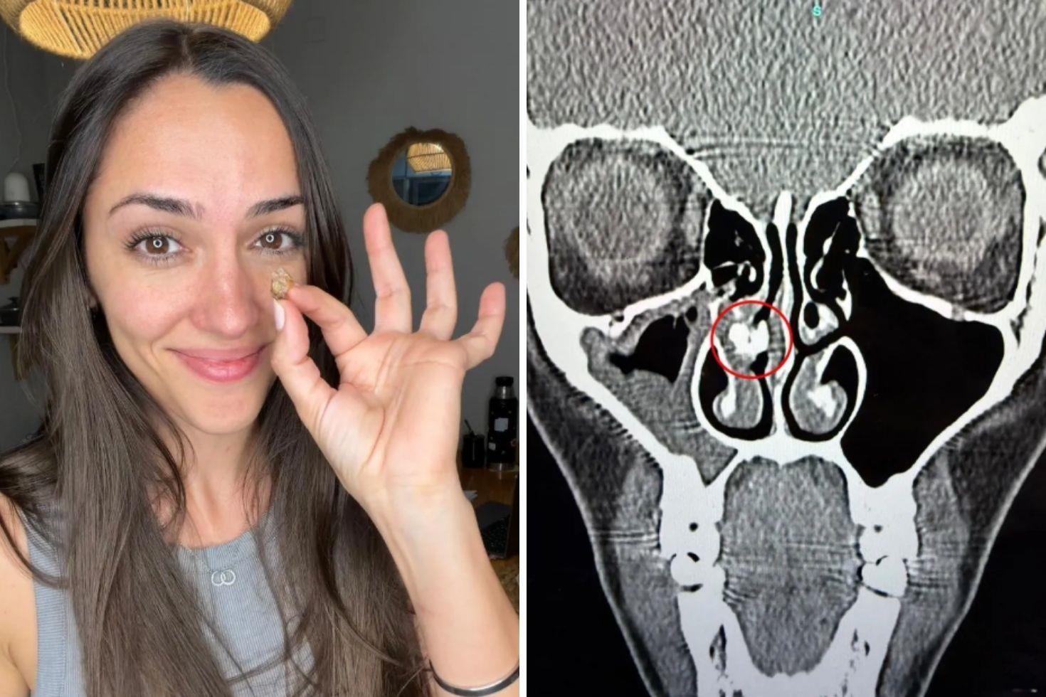 35 yıl sonra ortaya çıkan gerçek: Burnundan çıkan şeye kimse inanamadı