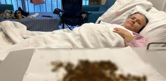 Karın ağrısı şikayetiyle gitti, çıkanları sağlık ekibi dahi sayamadı