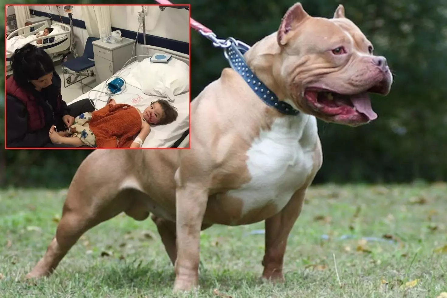 Pitbull dehşeti İki küçük kardeş ölümden döndü