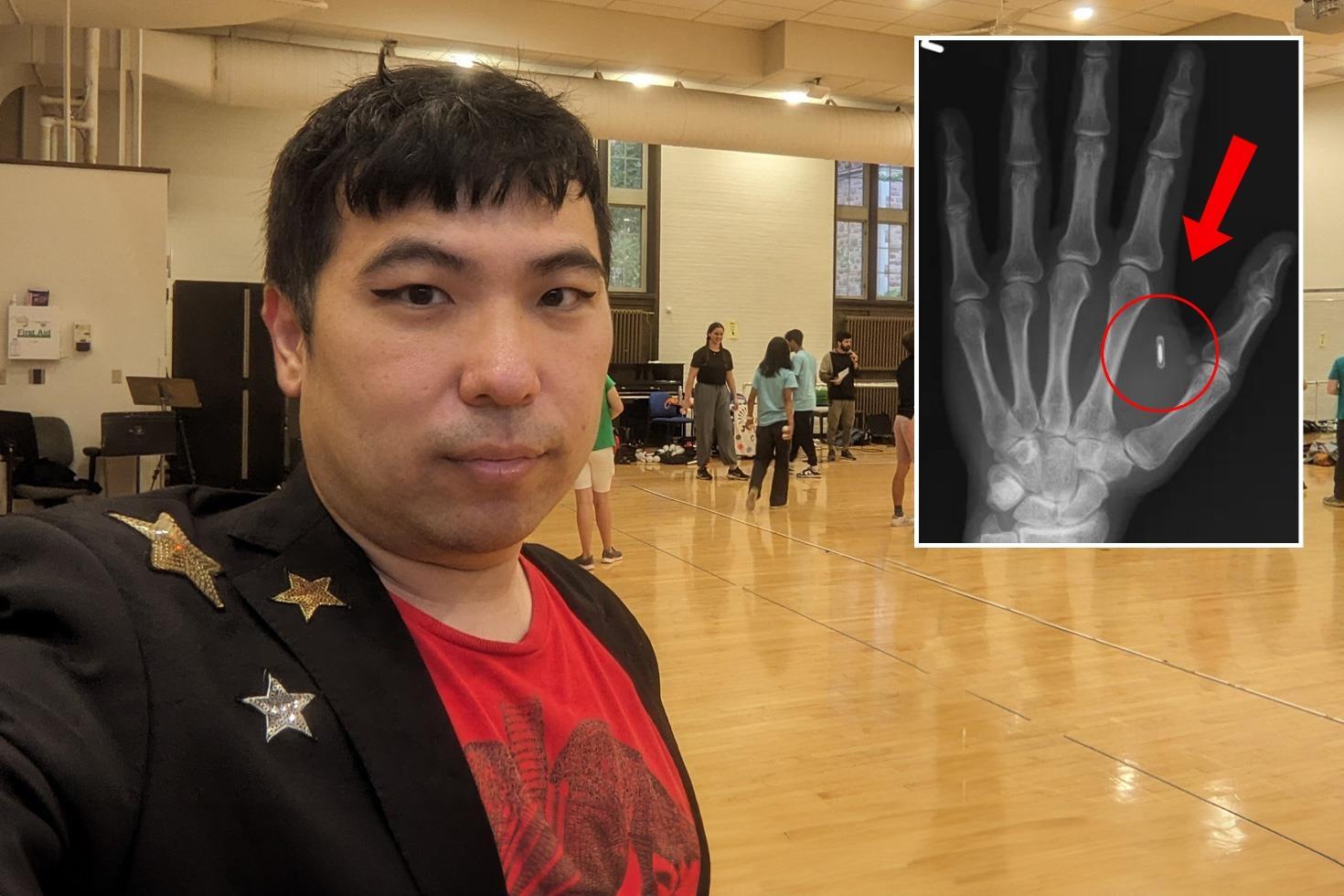 Akılalmaz hata Eline yerleşltirdiği mikroçipin şifresini unuttu