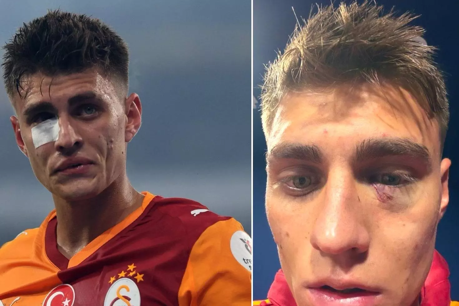 Kazımcan Karataş’a çakmak atan kişi hakkında karar çıktı