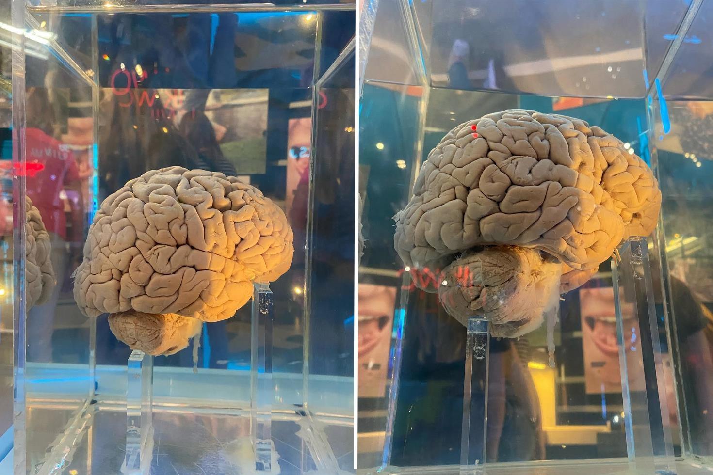 Amsterdam’daki dev arşiv: 5 bin 300 beyin yapay zeka ile haritalanacak