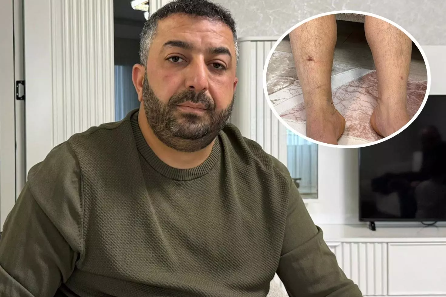 8 saat işkenceye uğradı, dehşetin altından ’yanlış anlaşılma’ çıktı