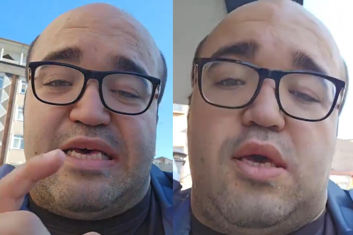 Diş tedavisi fiyatları araba fiyatını geçti