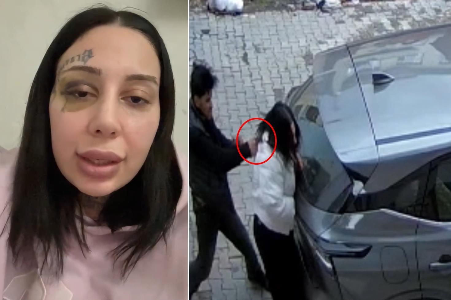 Sokak ortasında vahşet: Tecavüz etti, evlendik, şiddet başladı