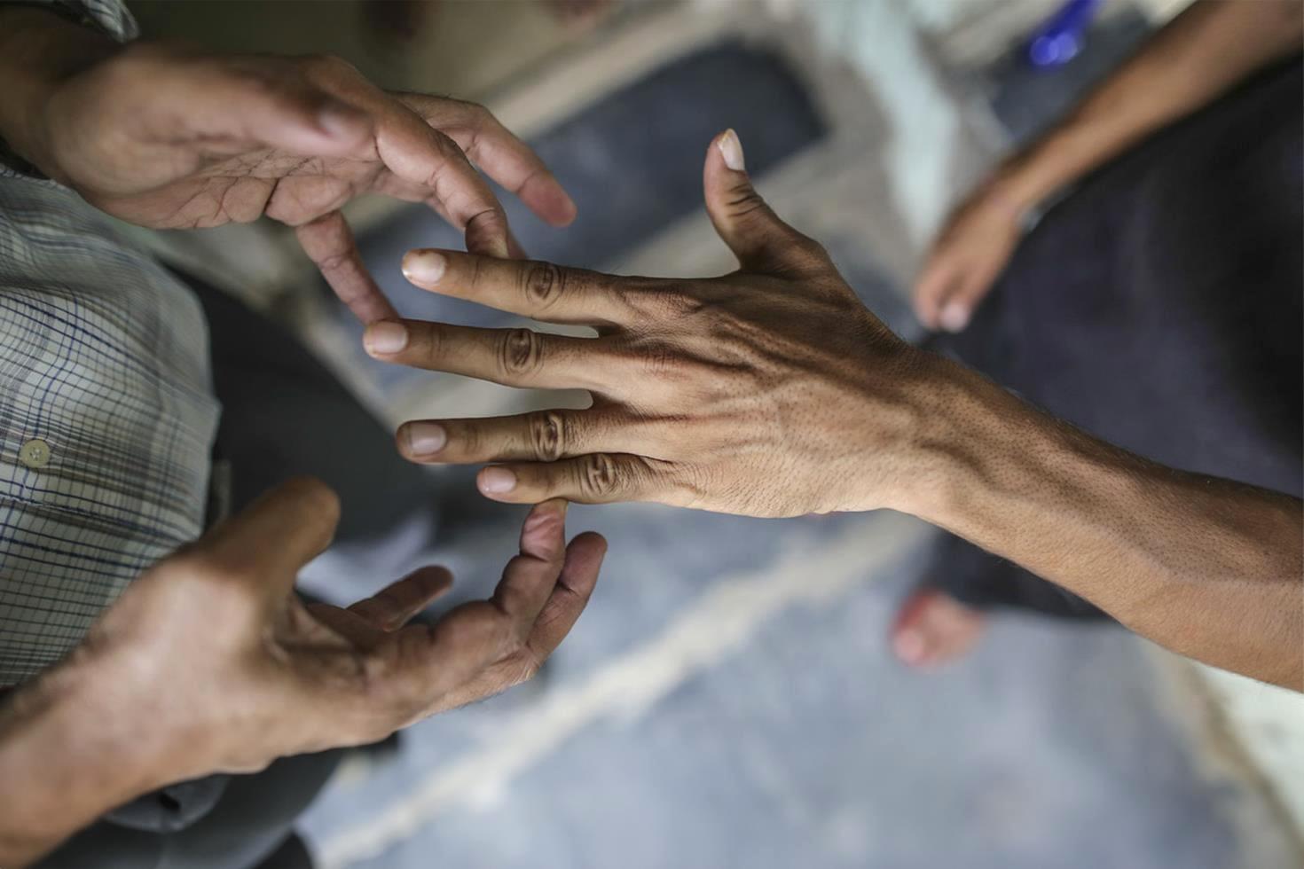 44 yıl sonra bir ilk 2 ülkede cüzzam vakaları görülmeye başladı