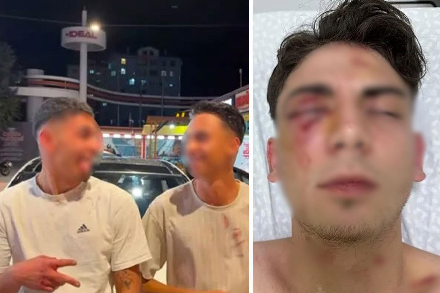 Muştalarla döverek kör ettiler, ellerinde kan ile video çektiler 1,5 ayda tahliye olan şüpheliler yeniden gözaltında