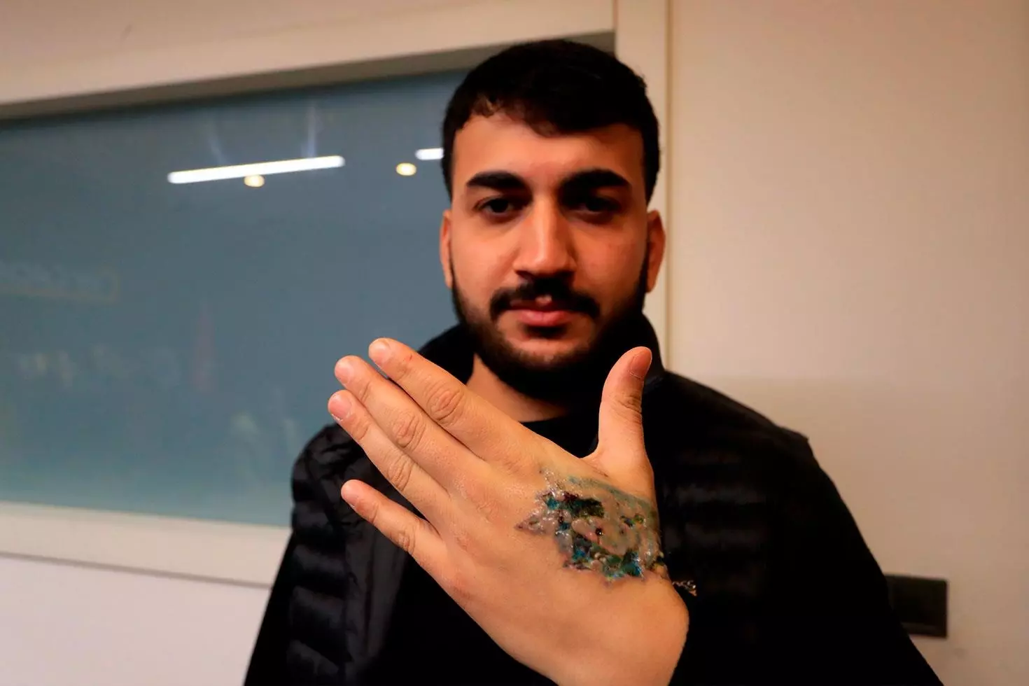 Gittiği güzellik merkezi hayatını karartı, aldığı cevap ile bir kez daha şok oldu