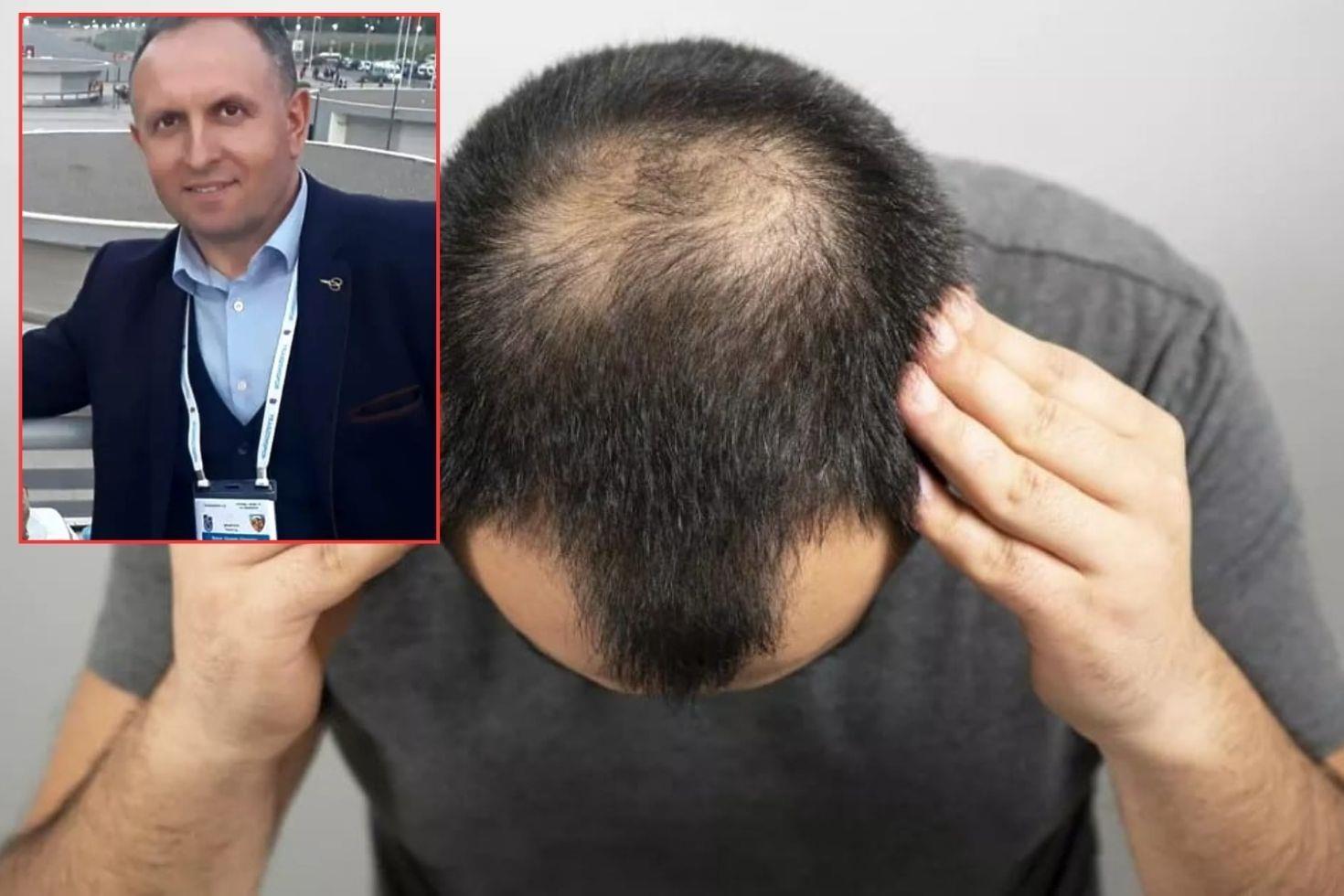 Saç ekimi sırasında fenalaştı, hayatını kaybetti