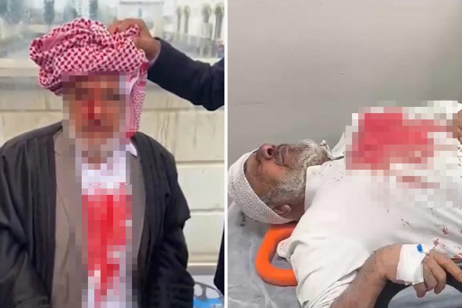 Şanlıurfa’da sopayla darba 4 tutuklama