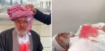 Şanlıurfa'da sopayla darba 4 tutuklama