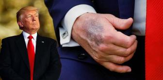 Trump elindeki morluğun nedenini açıkladı